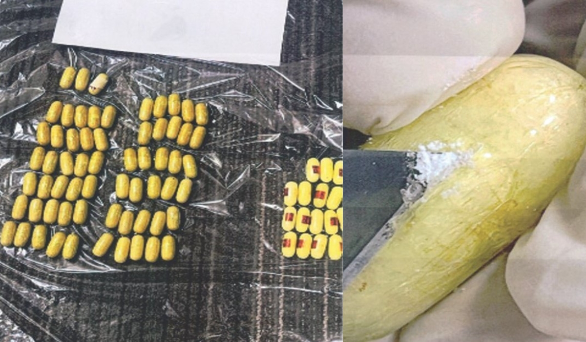 Qatar Customs Discovers 80 Narcotic Capsules Concealed In A Traveler's Stomach